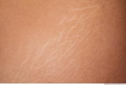 Photo Textures of Human Skin